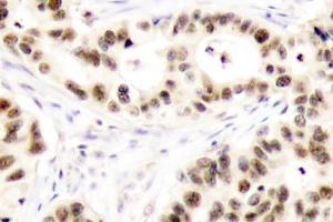 Image no. 1 for anti-ELK1, Member of ETS Oncogene Family (ELK1) antibody (ABIN265399)