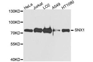 Western blot analysis of extracts of various cell lines, using SNX1 antibody. (Sorting Nexin 1 antibody  (AA 1-150))