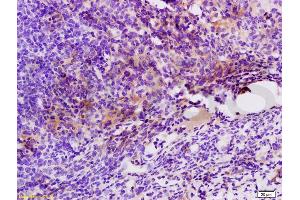 Formalin-fixed and paraffin embedded mouse colon carcinoma labeled with Anti-GPR49/LGR5 Polyclonal Antibody, Unconjugated (ABIN737916) at 1:200 followed by conjugation to the secondary antibody and DAB staining.