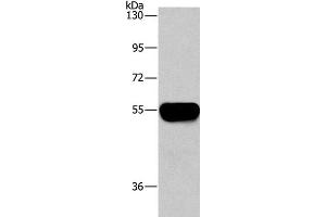 Western Blot analysis of Human plasma tissue using AHSG Polyclonal Antibody at dilution of 1:1450 (Fetuin A antibody)
