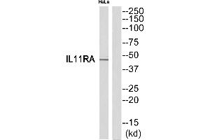 Western blot analysis of extracts from HeLa cells, using IL11RA antibody.