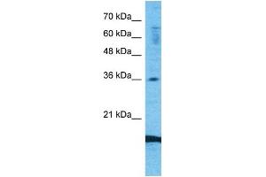 Host:  Rabbit  Target Name:  CCL18  Sample Type:  Fetal Lung lysates  Antibody Dilution:  1. (CCL18 antibody  (Middle Region))