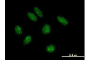 Immunofluorescence of purified MaxPab antibody to KIAA1456 on HeLa cell. (KIAA1456 antibody  (AA 1-367))