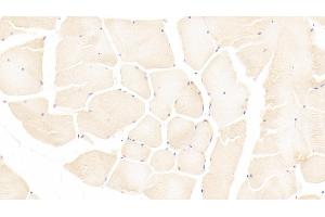 Immunohistochemistry (IHC) image for anti-Autocrine Motility Factor Receptor (AMFR) (AA 456-643) antibody (ABIN7444268)