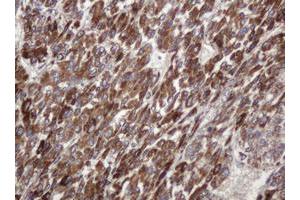 Image no. 1 for anti-TBC1 Domain Family, Member 13 (TBC1D13) antibody (ABIN1501310) (TBC1D13 antibody)
