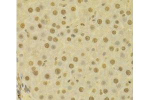 Immunohistochemistry of paraffin-embedded Human liver using COPS5 Polyclonal Antibody at dilution of 1:100 (40x lens). (COPS5 antibody)