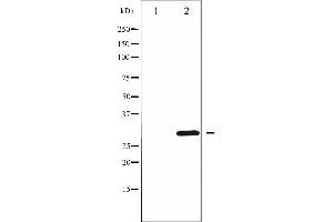 Western blot analysis of Cyclin D3 phosphorylation expression in UV treated K562 whole cell lysates,The lane on the left is treated with the antigen-specific peptide. (Cyclin D3 antibody  (pThr283))