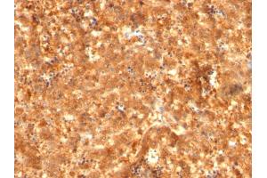 Formalin-fixed, paraffin-embedded human Fetal Liver stained with AFP Mouse Monoclonal Antibody (C2 + C3 + MBS-12).
