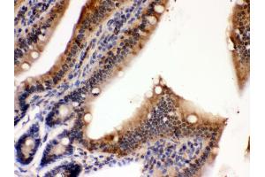 Anti- PDPK1 Picoband antibody, IHC(P) IHC(P): Mouse Intestine Tissue (PDPK1 antibody  (C-Term))