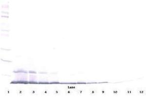 Image no. 1 for anti-Chemokine (C-C Motif) Ligand 22 (CCL22) antibody (ABIN464841) (CCL22 antibody)