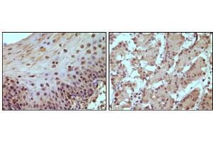 Immunohistochemical staining of paraffin-embedded human normal esophagus (A) and stomach (B) tissue, showing nucleus localization using Rb antibody with DAB staining. (Retinoblastoma 1 antibody)