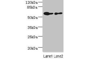 Western blot All lanes: CHRNA6 antibody at 2. (CHRNA6 antibody  (AA 26-239))