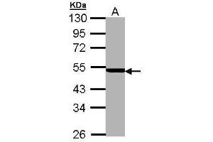 WB Image Sample (30 ug of whole cell lysate) A: MOLT4 , 10% SDS PAGE antibody diluted at 1:5000 (PSMC3 antibody)