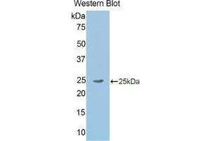 Detection of Recombinant GKN2, Rat using Polyclonal Antibody to Gastrokine 2 (GKN2) (Gastrokine 2 antibody  (AA 21-184))