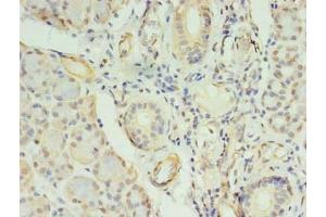 Immunohistochemistry of paraffin-embedded human pancreatic tissue using ABIN7148009 at dilution of 1:100 (COPB1 antibody  (AA 2-200))