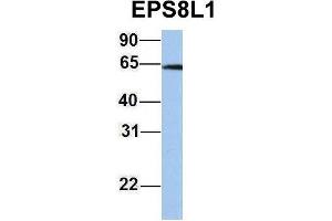Host:  Rabbit  Target Name:  EPS8L1  Sample Type:  Jurkat  Antibody Dilution:  1. (EPS8-Like 1 antibody  (Middle Region))