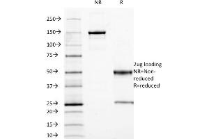 SDS-PAGE Analysis Purified CEA Mouse Monoclonal Antibody (C66/1009). (CEACAM5 antibody)