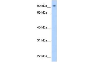WB Suggested Anti-ZNF408 Antibody Titration:  0. (ZNF408 antibody  (N-Term))