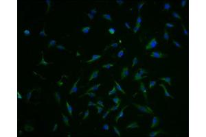 Immunofluorescence staining of U251 cells with ABIN7152226 at 1:100, counter-stained with DAPI. (SLC1A3 antibody  (AA 146-236))