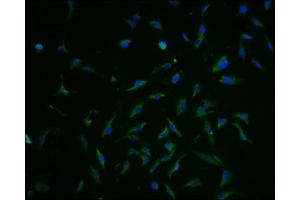 Immunofluorescence staining of U251 cells with ABIN7152226 at 1:100, counter-stained with DAPI. (SLC1A3 antibody  (AA 146-236))