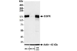 Western Blotting (WB) image for anti-Epidermal Growth Factor Receptor (EGFR) (C-Term) antibody (ABIN7795642) (Recombinant EGFR antibody  (C-Term))