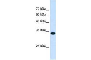 Image no. 2 for anti-Solute Carrier Family 25, Member 38 (SLC25A38) (AA 101-150) antibody (ABIN6736660)