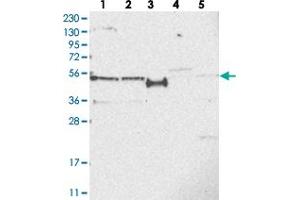 Western blot analysis of Lane 1: RT-4, Lane 2: U-251 MG, Lane 3: Human Plasma, Lane 4: Liver, Lane 5: Tonsil with SLCO4A1 polyclonal antibody . (SLCO4A1 antibody)