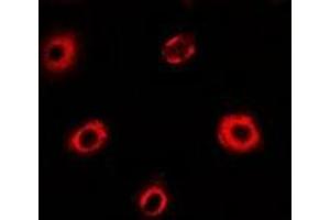 Immunofluorescent analysis of eIF4A1 staining in MCF7 cells. (EIF4A1 antibody)