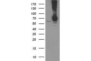 HEK293T cells were transfected with the pCMV6-ENTRY control (Left lane) or pCMV6-ENTRY RPN1 (Right lane) cDNA for 48 hrs and lysed. (RPN1 antibody)
