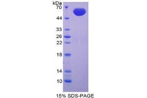SDS-PAGE (SDS) image for Fibrillin 2 (FBN2) (AA 1550-1791) protein (His tag,GST tag) (ABIN2122839)