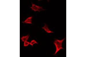 ABIN6266594 staining HuvEc by IF/ICC. (MMP19 antibody  (N-Term))