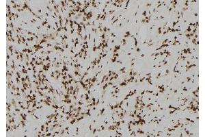 ABIN6272236 at 1/100 staining Human gastric tissue by IHC-P. (Acrosin antibody  (N-Term))