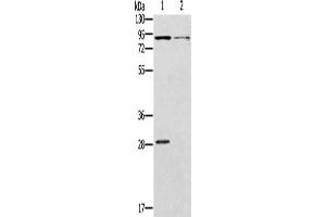 Gel: 8 % SDS-PAGE, Lysate: 40 μg, Lane 1-2: Mouse kidney tissue, Mouse brain tissue, Primary antibody: ABIN7128983(CNGA3 Antibody) at dilution 1/500, Secondary antibody: Goat anti rabbit IgG at 1/8000 dilution, Exposure time: 2 minutes (CNGA3 antibody)