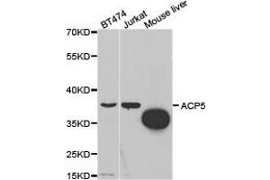 Western Blotting (WB) image for anti-Acid Phosphatase 5, Tartrate Resistant (ACP5) antibody (ABIN1870772) (ACP5 antibody)