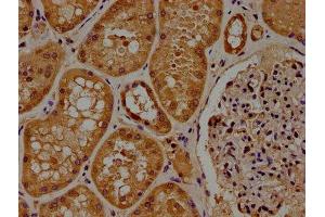 IHC image of ABIN7165952 diluted at 1:100 and staining in paraffin-embedded human kidney tissue performed on a Leica BondTM system. (PPM1J antibody  (AA 294-505))