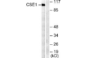 Western blot analysis of extracts from 293 cells, using CSantibody. (Exportin 2 antibody)