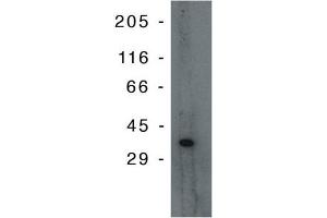 Western Blotting (WB) image for anti-Tumor Protein P53 Inducible Protein 3 (TP53I3) antibody (ABIN264400)