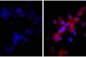 Human hepatocellular carcinoma cell line Hep G2 was stained with Rabbit IgG-UNLB isotype control, and DAPI. (Donkey anti-Rabbit IgG (Heavy & Light Chain) Antibody (Biotin))