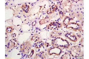 Formalin-fixed and paraffin embedded human kidney labeled with Anti-WNT12/WNT10B Polyclonal Antibody, Unconjugated (ABIN702295) at 1:200 followed by conjugation to the secondary antibody and DAB staining (WNT10B antibody  (AA 201-300))