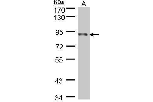 NDUFS1 antibody  (Center)