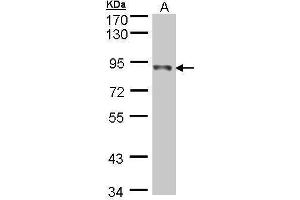 NDUFS1 antibody  (Center)
