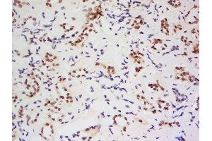Formalin-fixed and paraffin embedded human kidney labeled with Anti-AARE Polyclonal Antibody, Unconjugated  at 1:200 followed by conjugation to the secondary antibody and DAB staining. (APEH antibody  (AA 101-200))