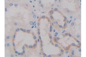 Detection of ADAM10 in Human Kidney Tissue using Polyclonal Antibody to A Disintegrin And Metalloprotease 10 (ADAM10) (ADAM10 antibody  (AA 420-641))