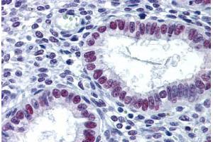 Human Uterus: Formalin-Fixed, Paraffin-Embedded (FFPE)