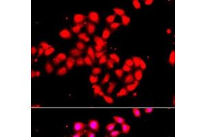 Immunofluorescence analysis of A549 cells using CAMK1D Polyclonal Antibody (CAMK1D antibody)