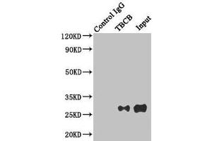 Immunoprecipitating TBCB in Hela whole cell lysate Lane 1: Rabbit control IgG instead of (1 μg) instead of ABIN7173734 in Hela whole cell lysate. (TBCB antibody  (AA 1-244))