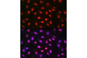Immunofluorescence analysis of U-2 OS cells using MDC1 Rabbit pAb (ABIN6134688, ABIN6143659, ABIN6143661 and ABIN6216452) at dilution of 1:150 (40x lens). (MDC1 antibody  (AA 1-100))