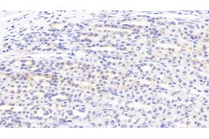 Detection of SLC in Rat Stomach Tissue using Polyclonal Antibody to Secondary Lymphoid Tissue Chemokine (SLC) (CCL21 antibody  (AA 5-132))