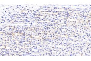 Detection of SLC in Rat Stomach Tissue using Polyclonal Antibody to Secondary Lymphoid Tissue Chemokine (SLC) (CCL21 antibody  (AA 5-132))