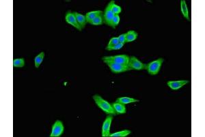 Immunofluorescent analysis of HepG2 cells using ABIN7156533 at dilution of 1:100 and Alexa Fluor 488-congugated AffiniPure Goat Anti-Rabbit IgG(H+L) (ICAM1 antibody  (AA 320-480))
